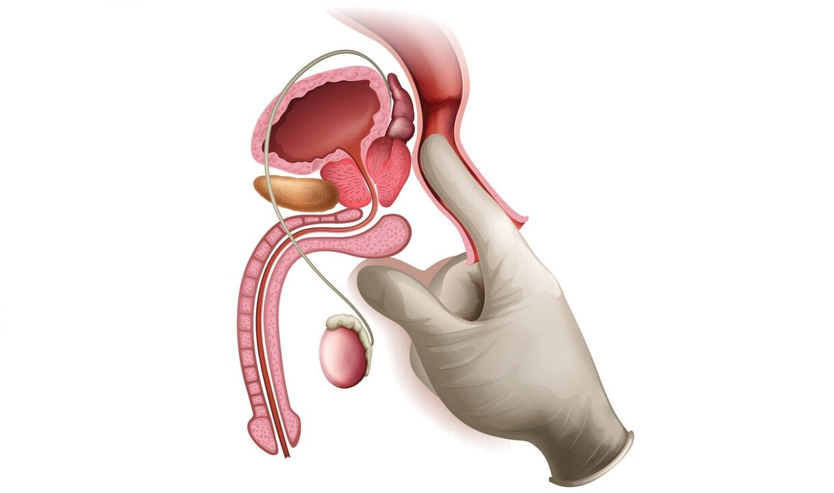 Prostata Massage fir Prostatitis